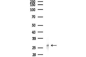 anti-NK2 Homeobox 8 (NKX2-8) (N-Term) antibody