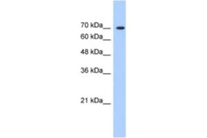 Western Blotting (WB) image for anti-LAS1-Like (LAS1L) antibody (ABIN2461009) (LAS1L Antikörper)