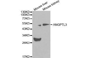 Western blot analysis of extracts of various cell lines, using ANGPTL3 antibody (ABIN5970263) at 1/1000 dilution.
