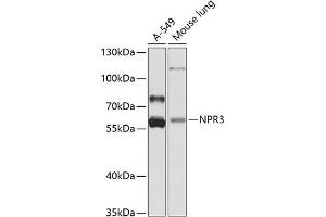 Western blot analysis of extracts of various cell lines, using NPR3 antibody (ABIN6133449, ABIN6144785, ABIN6144786 and ABIN6224163) at 1:1000 dilution. (NPR3 Antikörper  (AA 272-541))