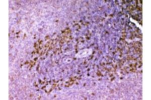 IHC testing of FFPE rat spleen tissue with Ada antibody at 1ug/ml. (ADA Antikörper  (AA 2-241))