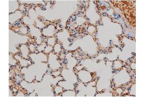 ABIN6267433 at 1/200 staining Mouse lung tissue sections by IHC-P.