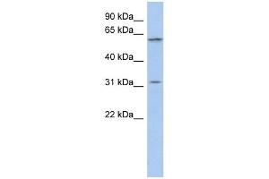 C1ORF110 antibody used at 1 ug/ml to detect target protein. (C1ORF110 Antikörper  (Middle Region))