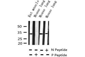 Western blot analysis of Phospho-BCL-XL (Ser62) expression in various lysates
