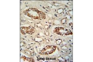 PPM1L antibody immunohistochemistry analysis in formalin fixed and paraffin embedded human lung tissue followed by peroxidase conjugation of the secondary antibody and DAB staining. (PPM1L Antikörper  (C-Term))