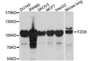 Western blot analysis of extracts of various cell lines, using FZD6 antibody. (FZD6 Antikörper  (AA 19-201))