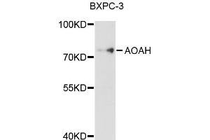 Western blot analysis of extracts of BxPC-3 cells, using AOAH antibody (ABIN4902917) at 1:1000 dilution.