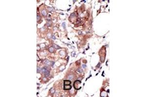 Immunohistochemistry (Paraffin-embedded Sections) (IHC (p)) image for anti-Muscle, Skeletal, Receptor Tyrosine Kinase (MUSK) (AA 829-859), (C-Term) antibody (ABIN392020)