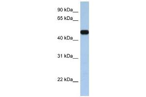 SLC25A46 antibody used at 1 ug/ml to detect target protein.