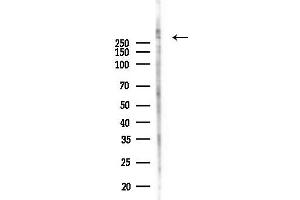 anti-Neurofibromin 1 (NF1) antibody