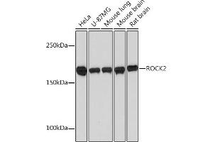Western blot analysis of extracts of various cell lines, using ROCK2 Rabbit mAb (ABIN7269972) at 1:1000 dilution. (ROCK2 Antikörper)