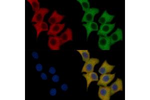 Flt3/CD135 Mouse Monoclonal Antibody staining HepG2 cells by IF/ICC. (FLT3 Antikörper  (C-Term))