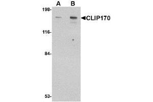 Image no. 1 for anti-CAP-GLY Domain Containing Linker Protein 1 (CLIP1) (C-Term) antibody (ABIN1492177) (CLIP1 Antikörper  (C-Term))