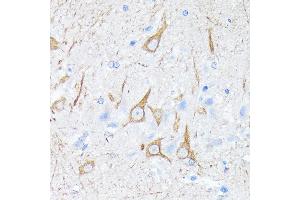 Immunohistochemistry of paraffin-embedded rat brain using Neurofilament H Rabbit mAb (ABIN7268866) at dilution of 1:100 (40x lens). (NEFH Antikörper)