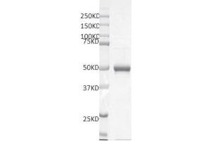 Recombinant SMYD5 protein gel. (SMYD5 Protein (DYKDDDDK Tag))