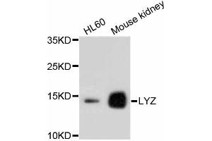 Western blot analysis of extracts of various cell lines, using LYZ antibody (ABIN4904274). (LYZ Antikörper)