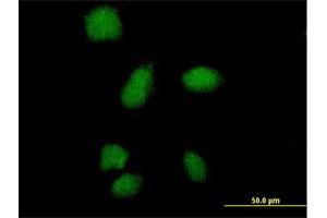 Immunofluorescence of purified MaxPab antibody to SMA4 on HeLa cell. (SMN1 Antikörper  (AA 1-140))