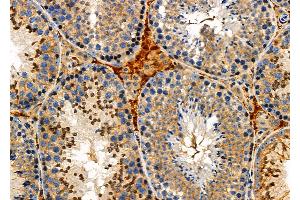 ABIN6259907 and ABIN6276919 at 1/100 staining Mouse testis tissue by IHC-P. (AMBP Antikörper  (C-Term))