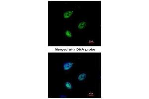 ICC/IF Image Immunofluorescence analysis of paraformaldehyde-fixed HeLa, using QIP1 , antibody at 1:200 dilution. (KPNA4 Antikörper  (C-Term))