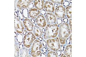 Immunohistochemistry of paraffin-embedded rat kidney using SNAPIN Rabbit pAb  at dilution of 1:200 (40x lens). (SNAPIN Antikörper  (AA 1-136))
