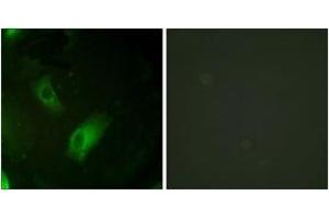 Immunofluorescence analysis of HeLa cells, using IREB1 (Ab-138) Antibody. (Aconitase 1 Antikörper  (AA 106-155))