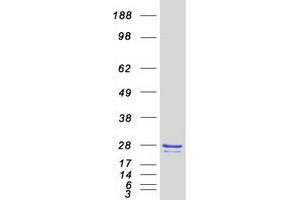 Validation with Western Blot (CBFB Protein (Transcript Variant 2) (Myc-DYKDDDDK Tag))