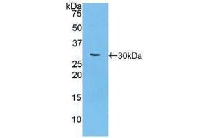Western blot analysis of recombinant Mouse CA125. (MUC16 Antikörper  (AA 2-258))