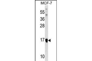 ITGB1BP1 Antibody (Center) (ABIN1537741 and ABIN2849156) western blot analysis in MCF-7 cell line lysates (35 μg/lane). (ITGB1BP1 Antikörper  (AA 108-136))