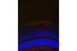 Immunofluorescence analysis of mouse retina using RDH5 Polyclonal Antibody (ABIN6130851, ABIN6146839, ABIN6146840 and ABIN6224076) at dilution of 1:100 (40x lens). (RDH5 Antikörper  (AA 24-318))