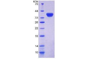 SDS-PAGE analysis of Rat GBP4 Protein. (GBP4 Protein)