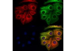 ABIN6265995 and ABIN6273344 staining Hela cells by IF/ICC. (VPS11 Antikörper  (Internal Region))
