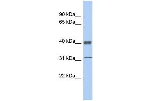 WB Suggested Anti-YBX1 Antibody Titration:  0.