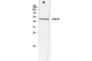 Western Blot (WB) analysis of KB lysis using COX10 antibody. (COX10 Antikörper  (Internal Region))