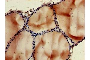 Immunohistochemistry of paraffin-embedded human thyroid tissue using ABIN7168384 at dilution of 1:100 (NOB1 Antikörper  (AA 103-229))