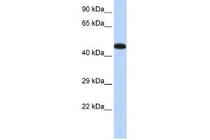 AKAP5 antibody used at 1 ug/ml to detect target protein. (AKAP5 Antikörper)