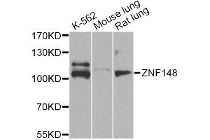 Western blot analysis of extracts of various cell lines, using ZNF148 Antibody (ABIN5974210) at 1/1000 dilution. (ZNF148 Antikörper)