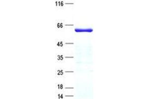 Validation with Western Blot (ZNF20 Protein (His tag))