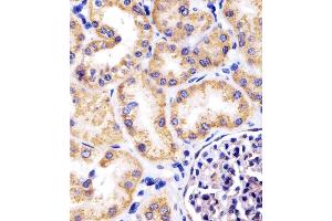 (ABIN6242389 and ABIN6578670) staining Hsp60 in human kidney tissue sections by Immunohistochemistry (IHC-P - paraformaldehyde-fixed, paraffin-embedded sections). (HSPD1 Antikörper  (AA 340-374))