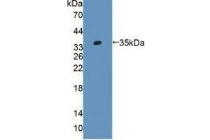 AGXT2 anticorps  (AA 225-512)