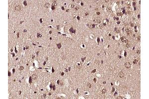 Paraformaldehyde-fixed, paraffin embedded mouse brain tissue, Antigen retrieval by boiling in sodium citrate buffer (pH6. (Glutamate Receptor 1 Antikörper  (pSer863))