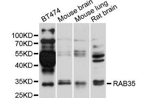 Western blot analysis of extracts of various cell lines, using RAB35 antibody (ABIN5995506) at 1/1000 dilution. (RAB35 Antikörper)