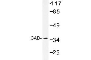 Image no. 1 for anti-DNA Fragmentation Factor, 45kDa, alpha Polypeptide (DFFA) antibody (ABIN272297) (DFFA Antikörper)