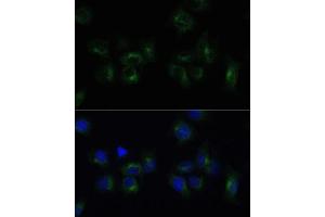 Immunofluorescence analysis of HeLa cells using CLTB Polyclonal Antibody (ABIN6131587, ABIN6138750, ABIN6138751 and ABIN6224454) at dilution of 1:100 (40x lens). (CLTB Antikörper  (AA 1-211))