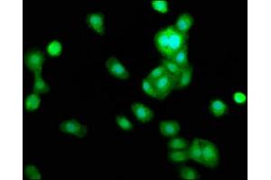 Immunofluorescence staining of HepG2 cells with ABIN7173357 at 1:166, counter-stained with DAPI. (TRIB1 Antikörper  (AA 3-91))