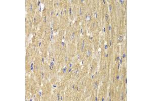 Immunohistochemistry of paraffin-embedded mouse heart using NCF2 antibody at dilution of 1:100 (400x lens). (NCF2 Antikörper)