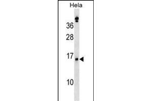 SLPI Antibody (Center) (ABIN1538516 and ABIN2848668) western blot analysis in Hela cell line lysates (35 μg/lane). (SLPI Antikörper  (AA 59-88))