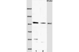 L1 rat heart lysate L2 rat kidney lysates probed with Anti VLDL Polyclonal Antibody, Unconjugated (ABIN705551) at 1:200 overnight at 4 °C. (VLDLR Antikörper  (AA 551-650))