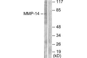 Western Blotting (WB) image for anti-Matrix Metallopeptidase 14 (Membrane-inserted) (MMP14) (C-Term) antibody (ABIN1848674) (MMP14 Antikörper  (C-Term))