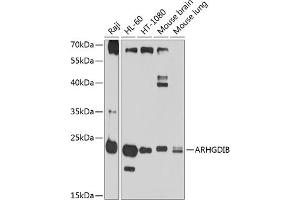 Western blot analysis of extracts of various cell lines, using ARHGDIB antibody (ABIN1678741, ABIN3018028, ABIN3018029 and ABIN6220341) at 1:1000 dilution. (ARHGDIB Antikörper  (AA 1-201))