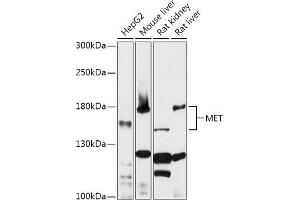 Western blot analysis of extracts of various cell lines, using MET antibody (ABIN1513199, ABIN5663553, ABIN5663555 and ABIN6213594) at 1:1000 dilution. (c-MET Antikörper  (AA 25-325))